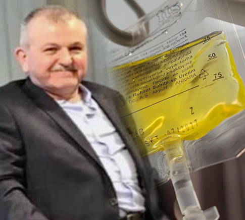 Yine sarı serum